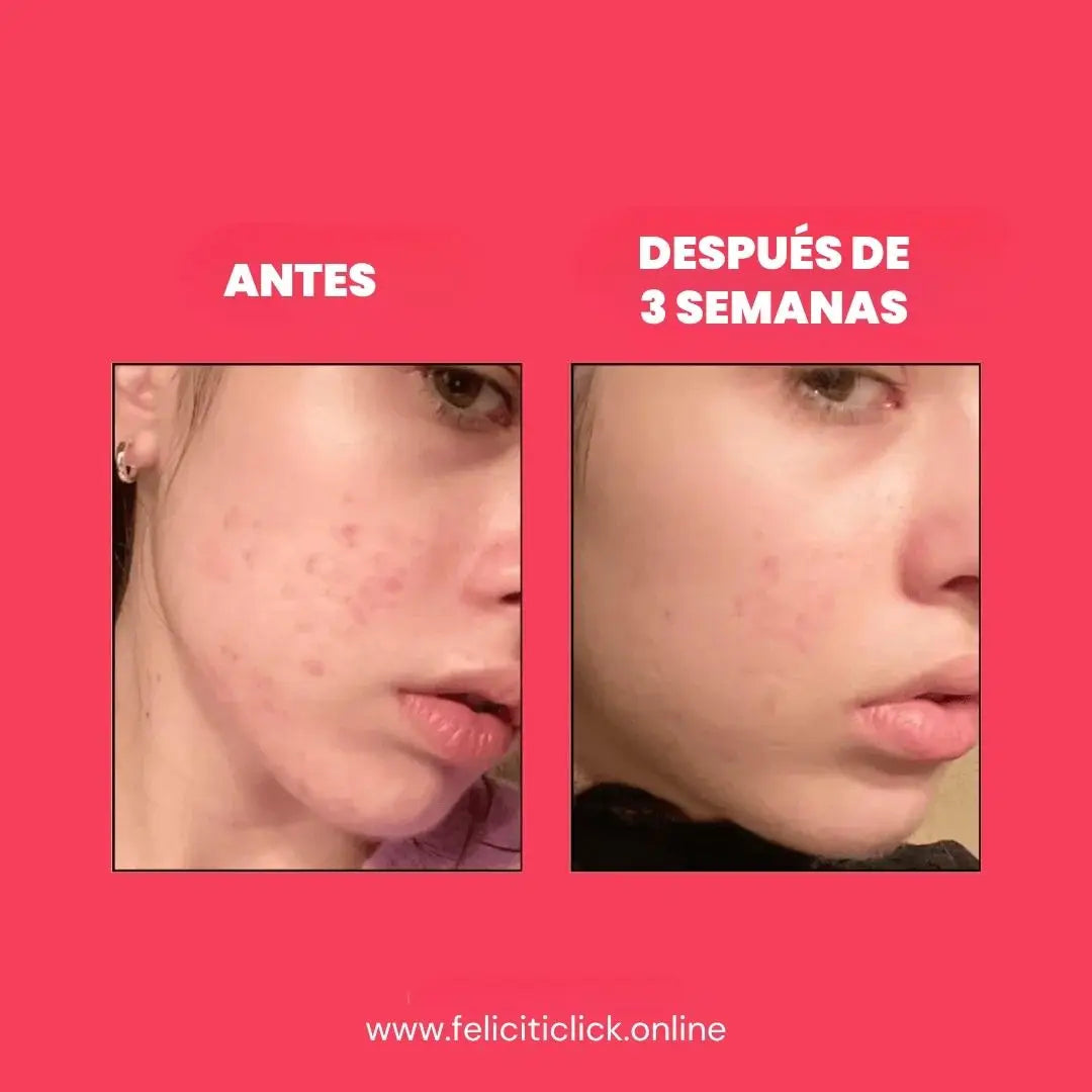 ANUA NIACINAMIDE 10% + TXA 4% - Sérum premium para las manchas oscuras